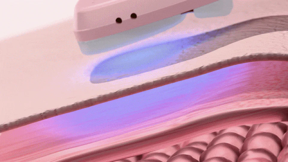 Thumbnail 48