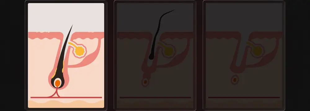 Thumbnail 25