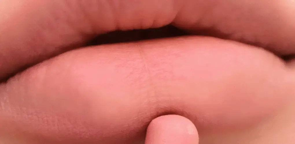 Thumbnail 61
