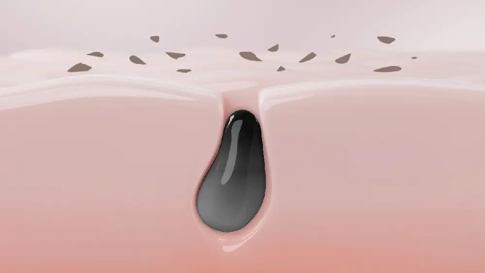 Thumbnail 25